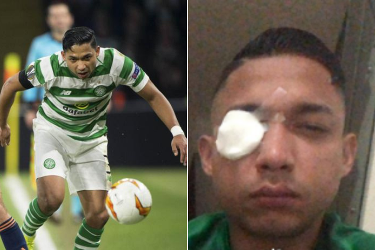 Emilio Izaguirre suffers glass in eye after violent Honduras derby saw three killed