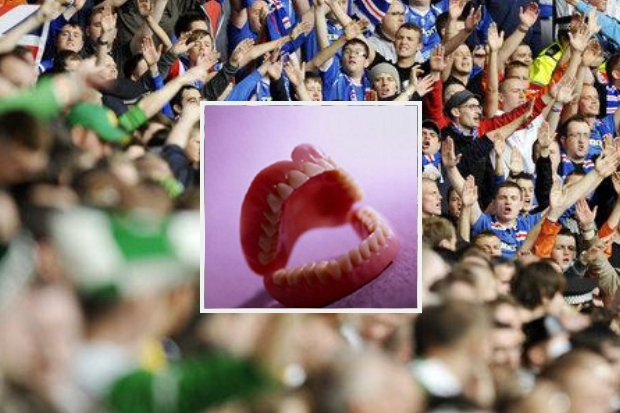 Glasgow pub reveals punter left behind false teeth after Rangers v Celtic